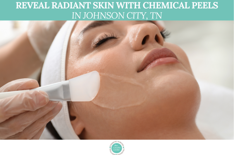 Reveal Radiant Skin with Chemical Peels in Johnson City, TN