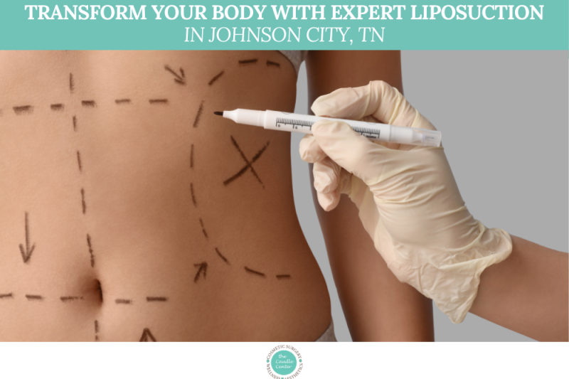 Transform Your Body with Expert Liposuction in Johnson City, TN