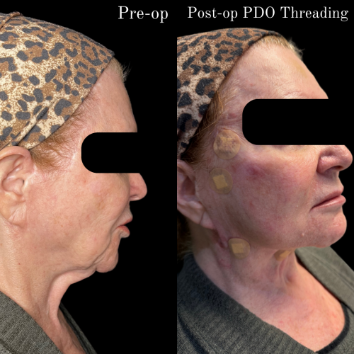 PDO-Threads-2